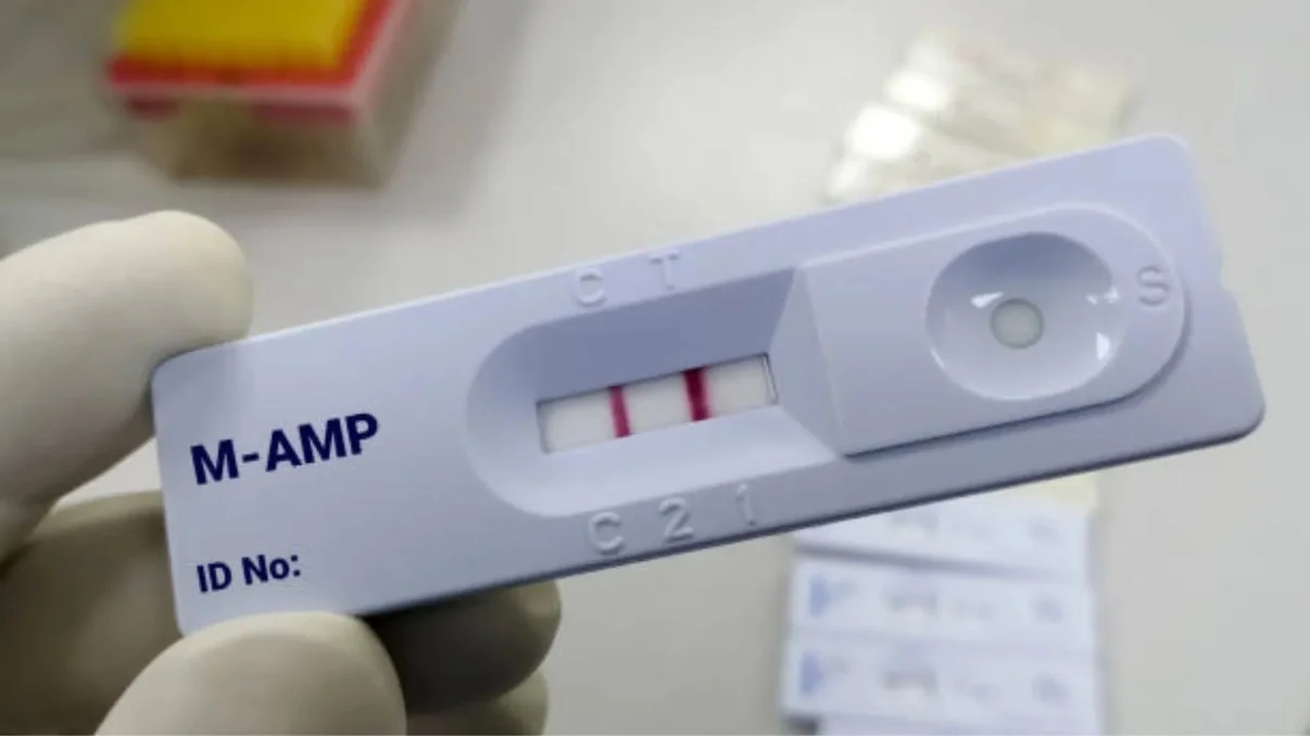 What Does AMP Mean on a Drug Test? Detection, Effects, and Employer Guidelines
