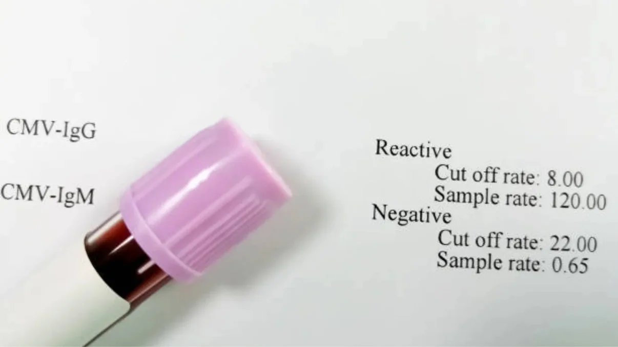 DOT Drug and Alcohol Test Cut-Off Levels Explained: A Complete Guide for Employers and Drivers